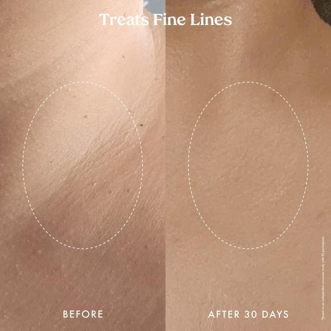 Kopari Ultra Renewal Retinol Body Cream, Infused with Acai & Encapsulated Retinol, Treat Fine Lines & Crepey Skin, Resurface & Boosts Collagen, 4.7 oz