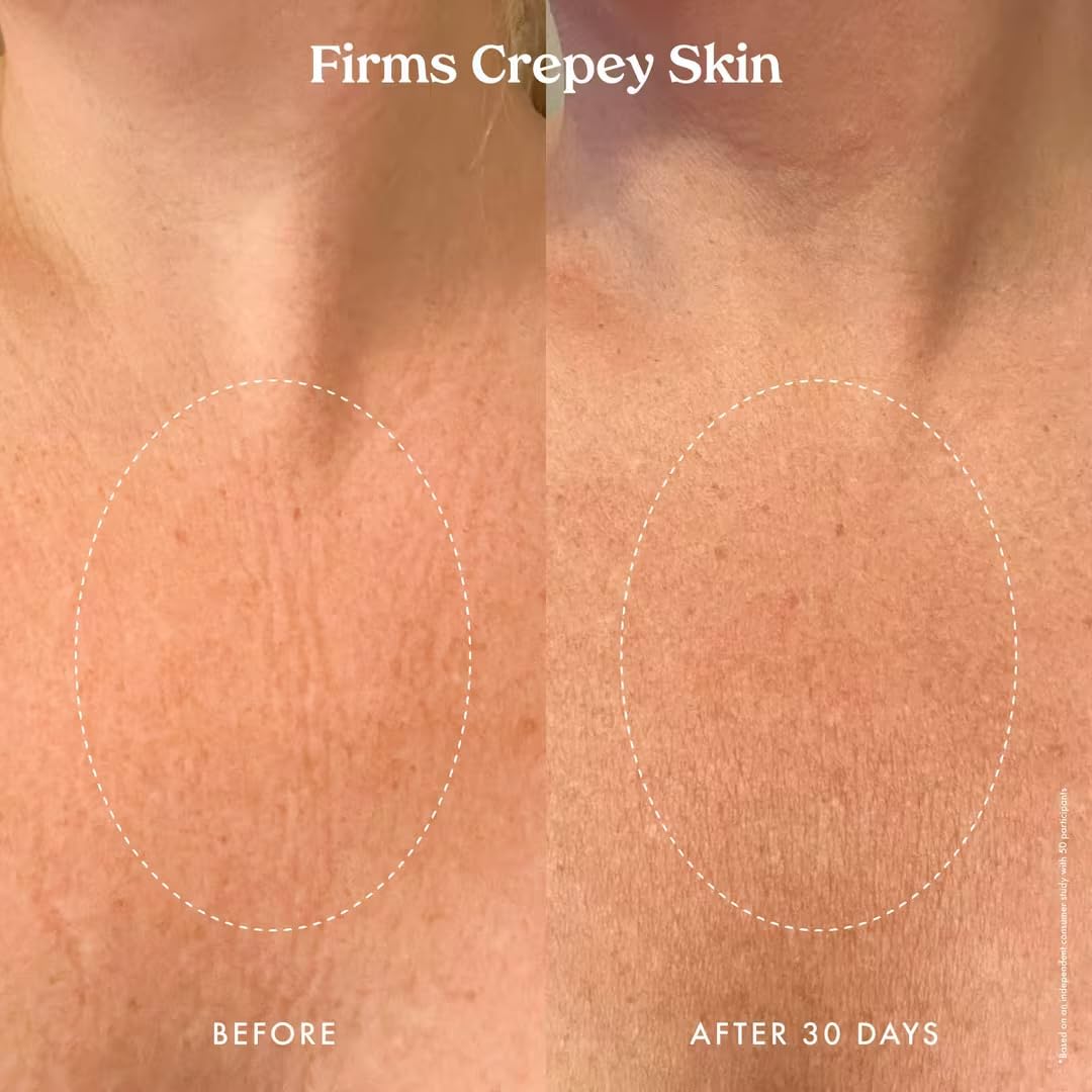 Kopari Ultra Renewal Retinol Body Cream, Infused with Acai & Encapsulated Retinol, Treat Fine Lines & Crepey Skin, Resurface & Boosts Collagen, 4.7 oz