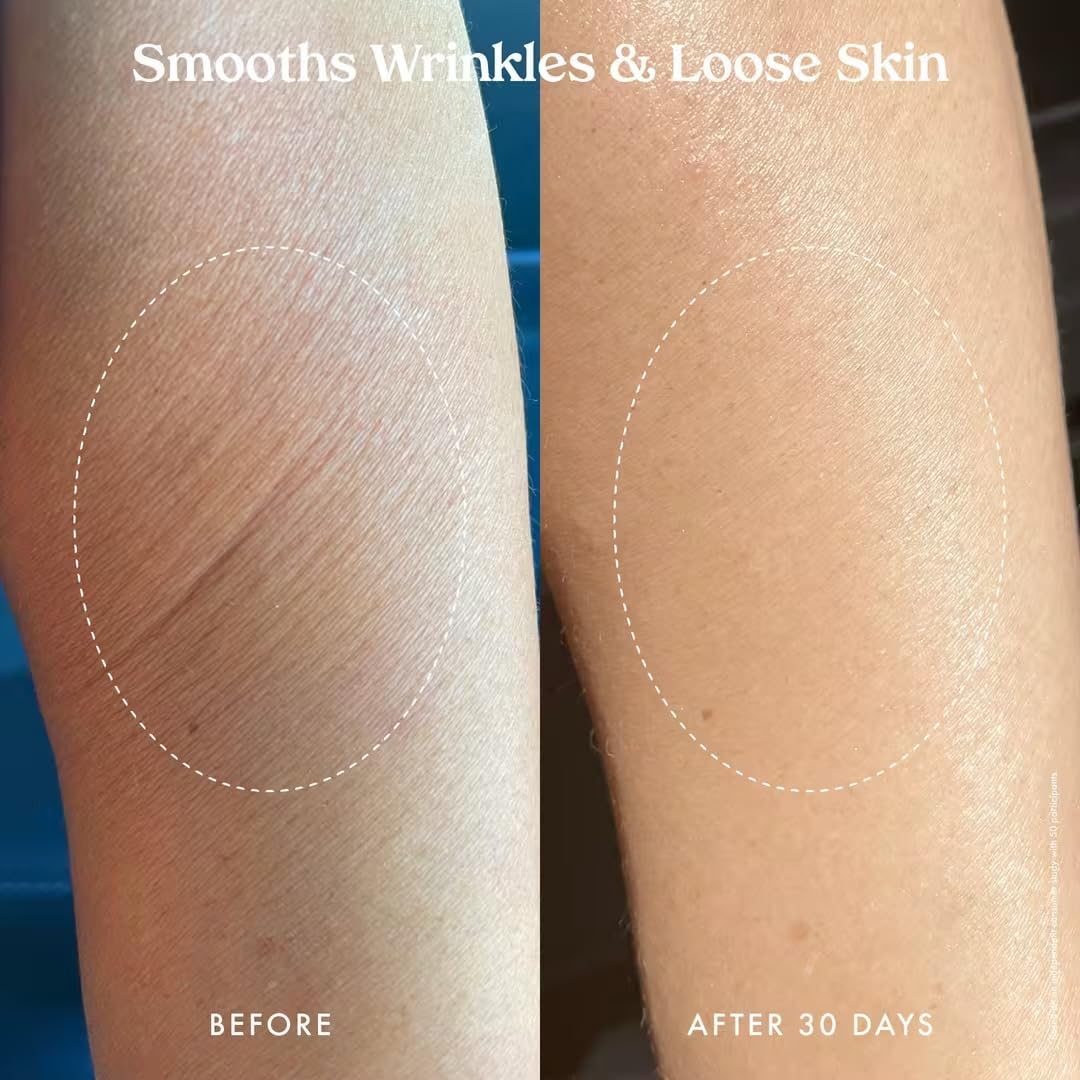 Kopari Ultra Renewal Retinol Body Cream, Infused with Acai & Encapsulated Retinol, Treat Fine Lines & Crepey Skin, Resurface & Boosts Collagen, 4.7 oz